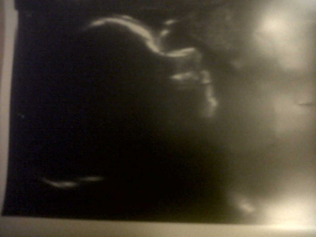 IMG00161-20110224-2216.jpg